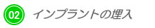 インプラントの埋入